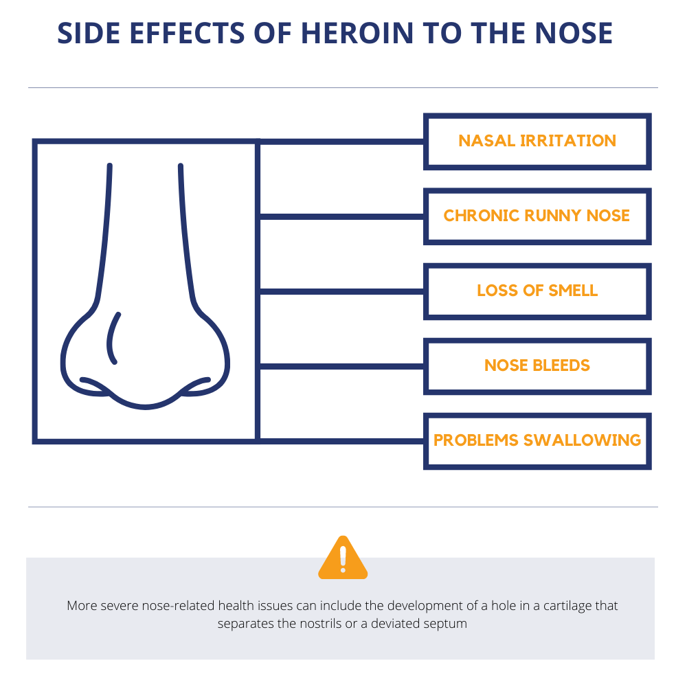 side effects of heroin to the nose