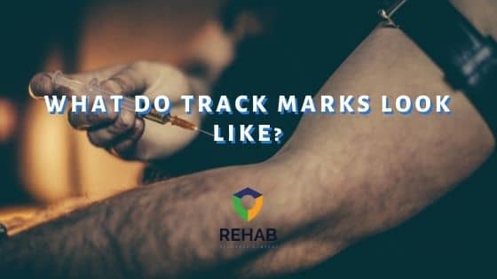 What Do Track Marks Look Like?